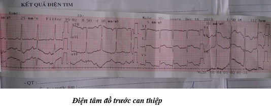 NMCT1