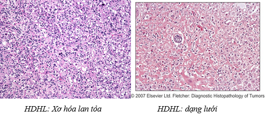 hiengpb11