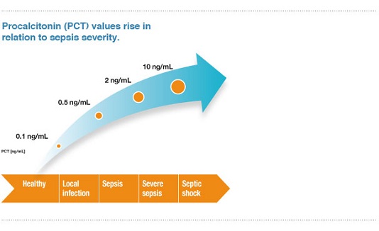 procalcitonin1