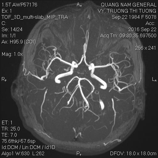 mri1