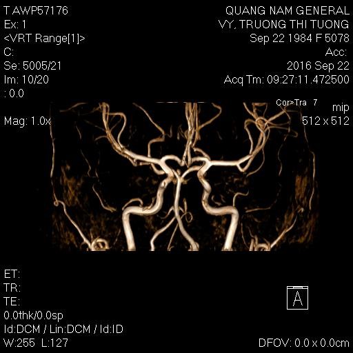 mri5