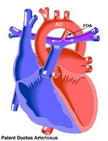 pda