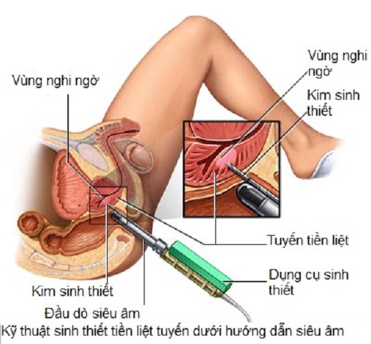 sinhthiettlt