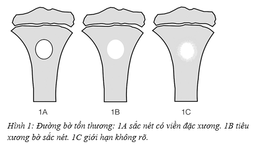 xuongte1