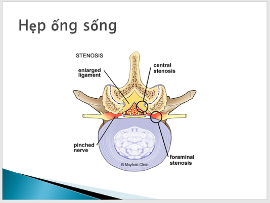 hepongsong