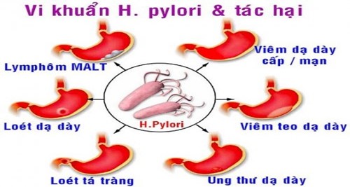 vkpylori