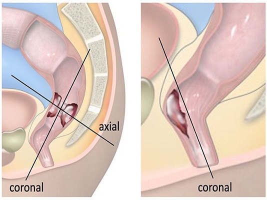 MRI K