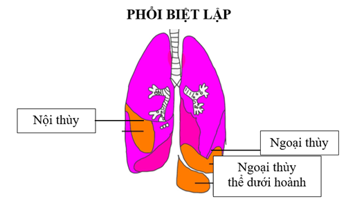 bietlap