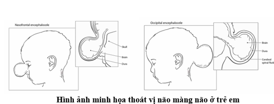 thoatvinao3